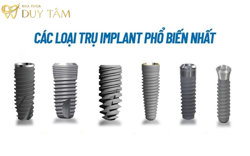 Các loại trụ Implant phổ biến nhất hiện nay