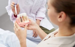 Trồng răng Implant cho người cao tuổi là giải pháp an toàn cải thiện chất lượng cuộc sống