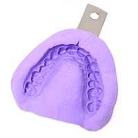 Quy Trinh Implant 3