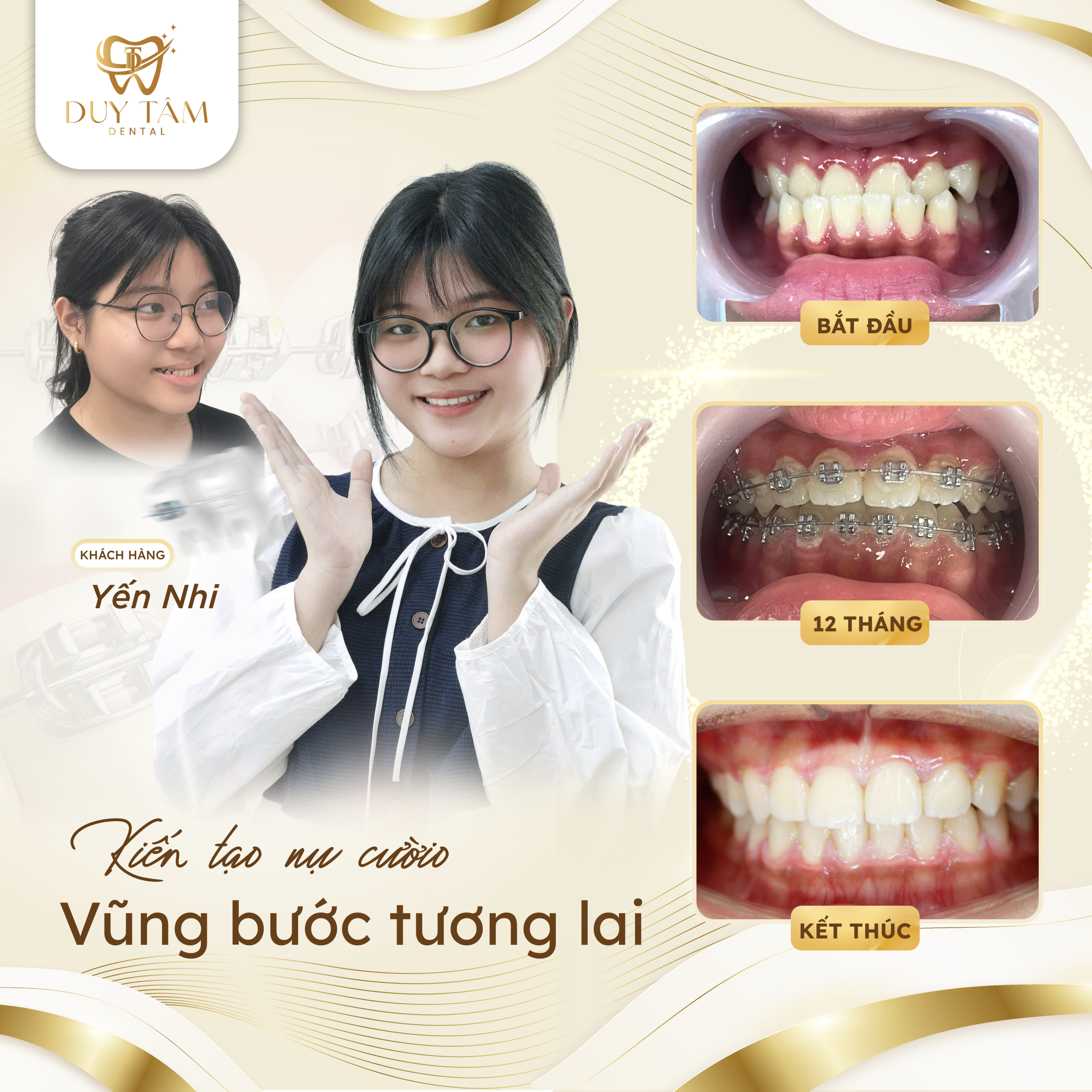 Nha Khoa Niềng Răng Trả Góp Uy Tín Tại Quy Nhơn