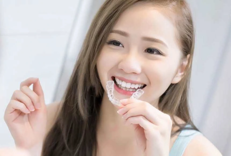 Niềng răng trong suốt là gì?