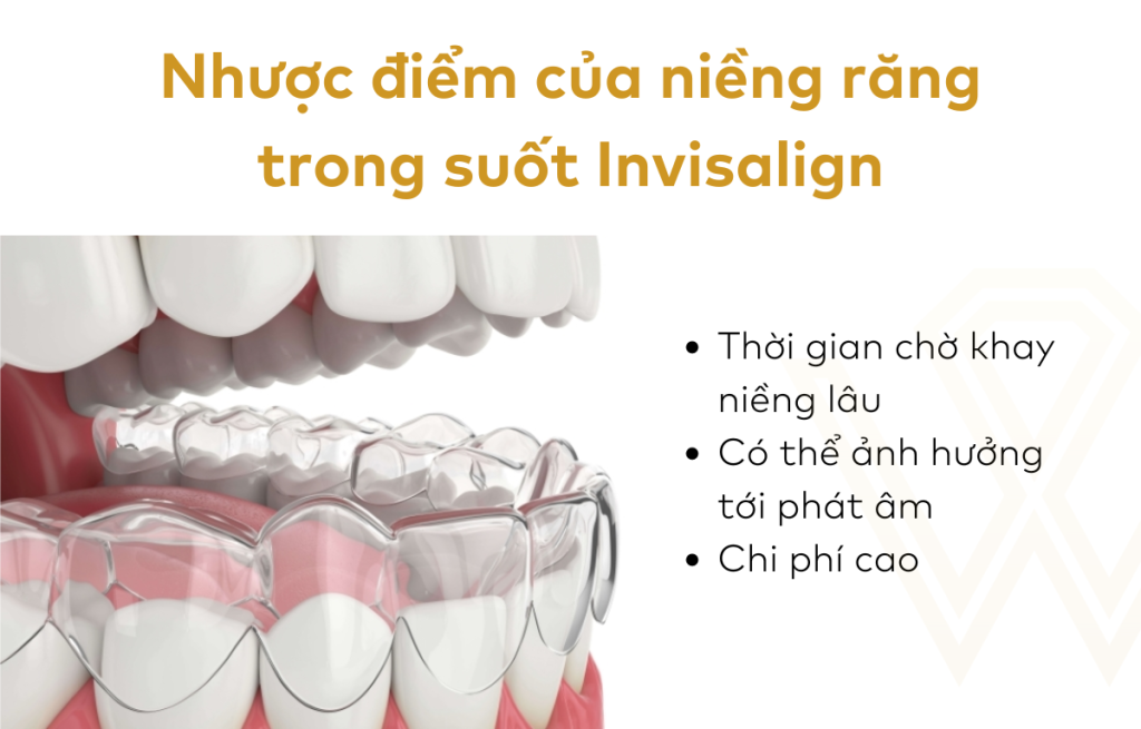Nhược điểm của niềng răng trong suốt